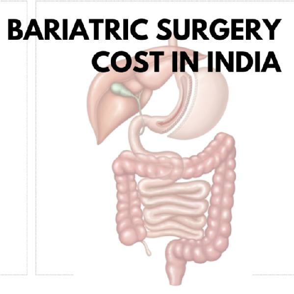 BARIATRIC SURGERY COST IN INDIA