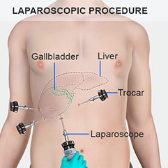 Jindal Endo Laparoscopy Hospital