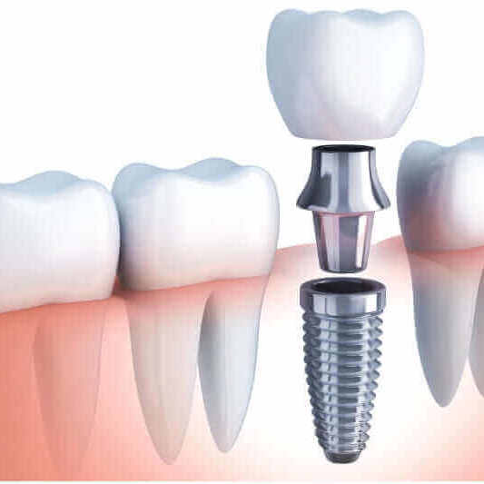 FDOC- Multispeciality Dental Chains