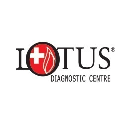 Diagnostic Centre in Indiranagar and Koramangala | Lotus Diagnostic Centre