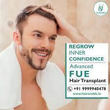 Hair Loss Treatment Clinic in Delhi NCR