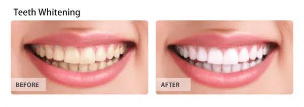 Images from Dentapex - Dentist In Schofield