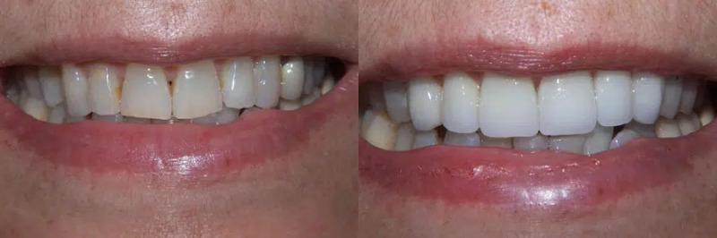 Images from Dentapex - Dentist In Schofield