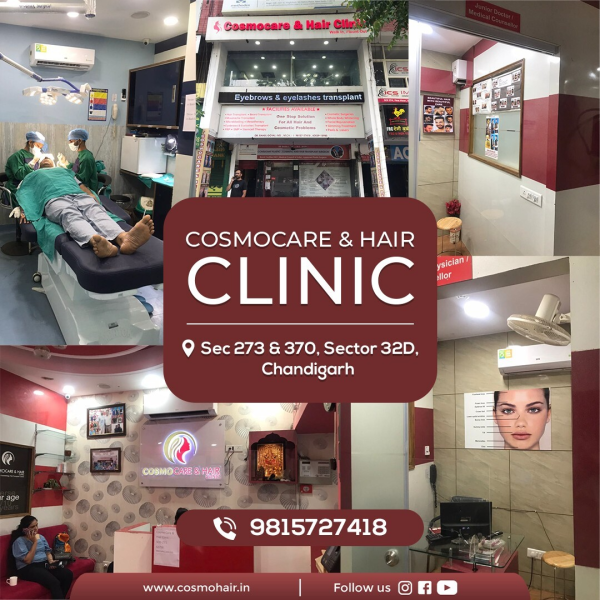 Cosmo Care & Hair Transplant Clinic Chandigarh