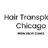 Hair Transplant Chicago