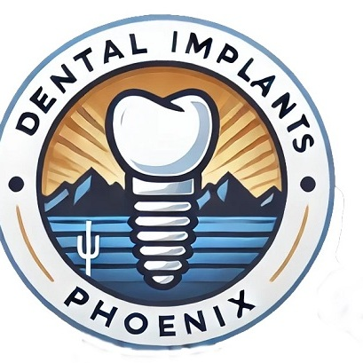 Dental Implants Phoenix