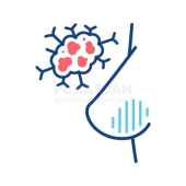 Breast Cancer - Startupxplore Breast Cancer