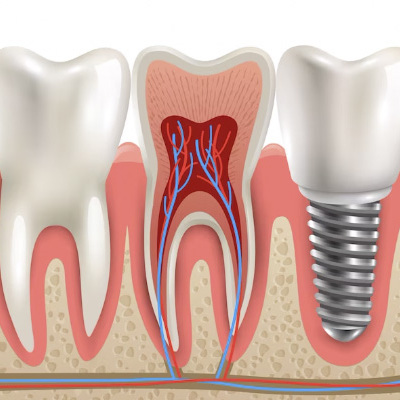 Happy Dental Health Care, Elevating Oral Care in Vijayawada