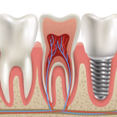 Happy Dental Health Care, Elevating Oral Care in Vijayawada - Startupxplore Happy Dental Health Care, Elevating Oral Care in Vijayawada