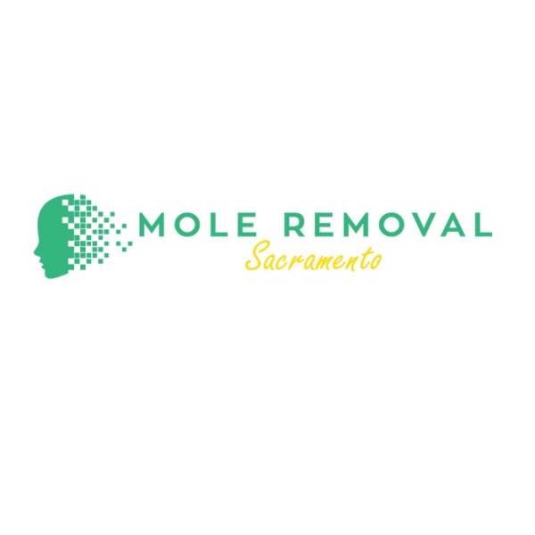 Mole Removal Sacramento