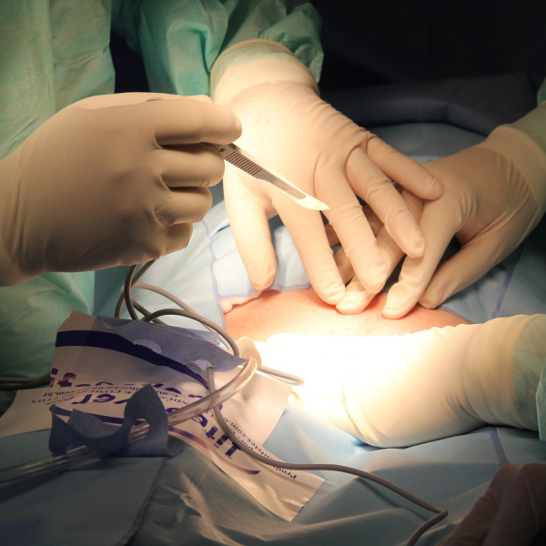 Minimally Invasive Spine Surgery Phoenix